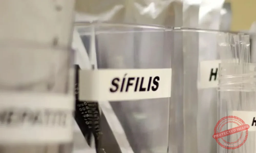 Sifilis