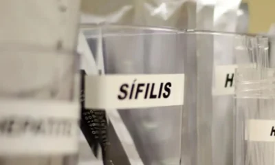 Sifilis