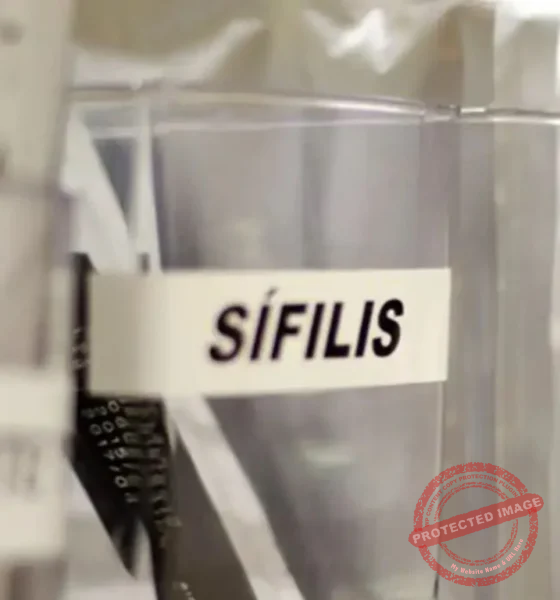 Sifilis